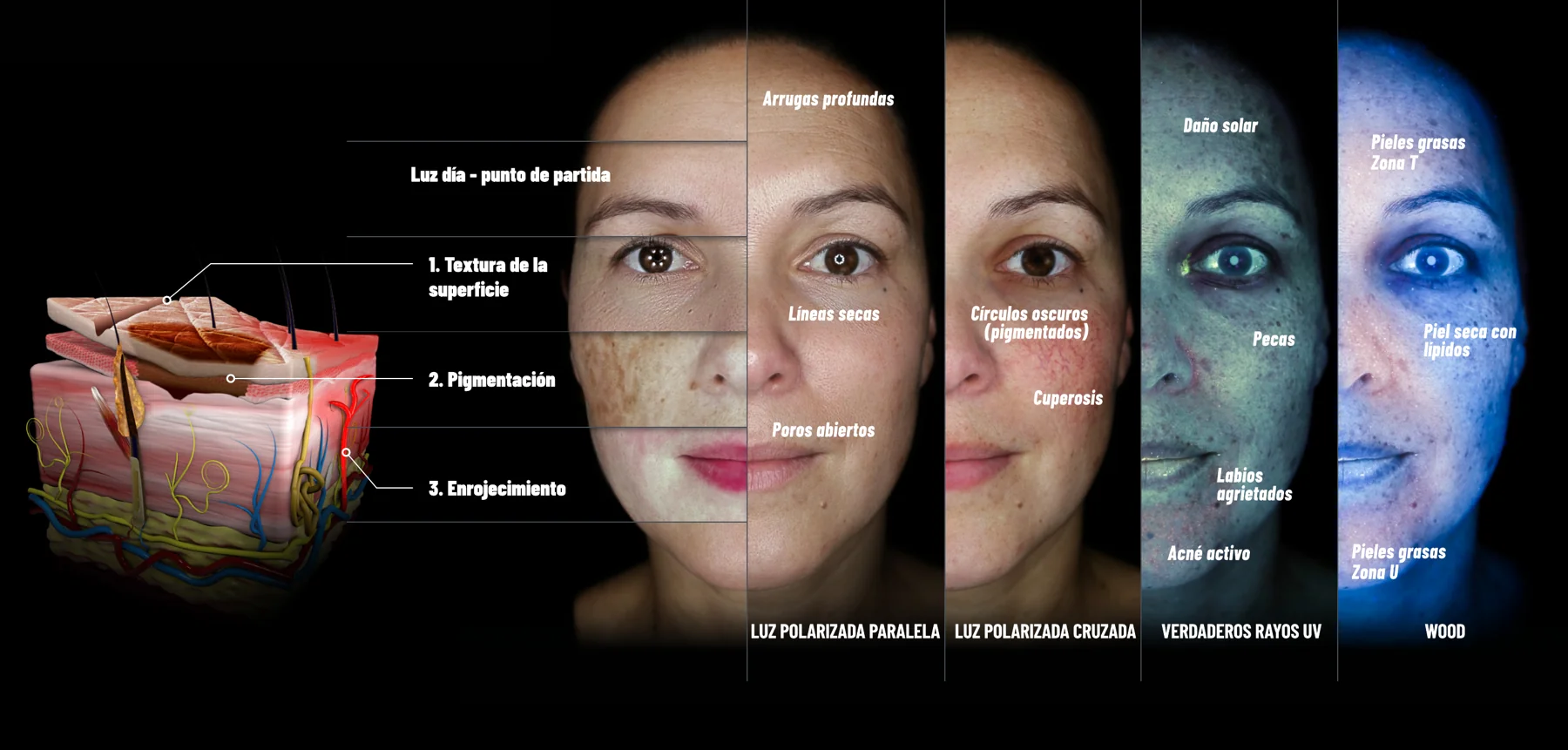 Qué revela cada tipo de luz: manchas, cuperosis, daño solar, poros y zonas grasas