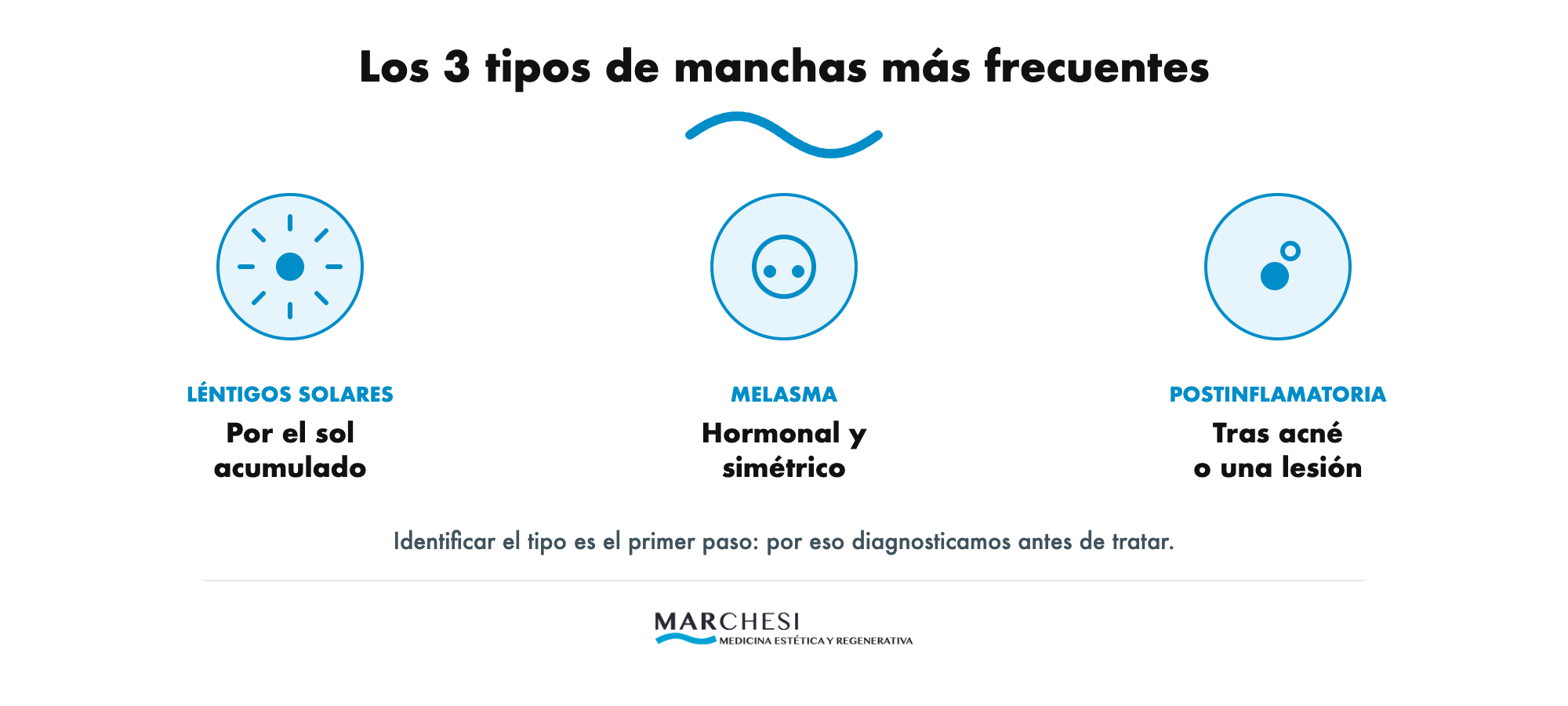 Los 3 tipos de manchas más frecuentes: léntigos solares, melasma e hiperpigmentación postinflamatoria — Clínica Marchesi, Málaga